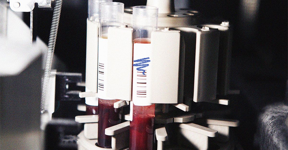 Blood test may detect 'signatures' to predict onset of 67 diseases