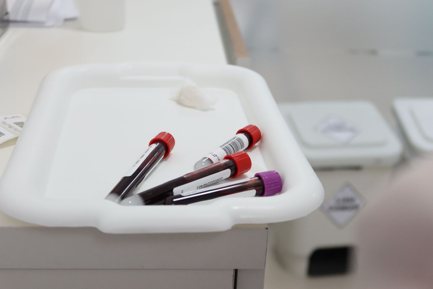 New Alzheimer’s Blood Tests Could Reduce Diagnosis Time by Years