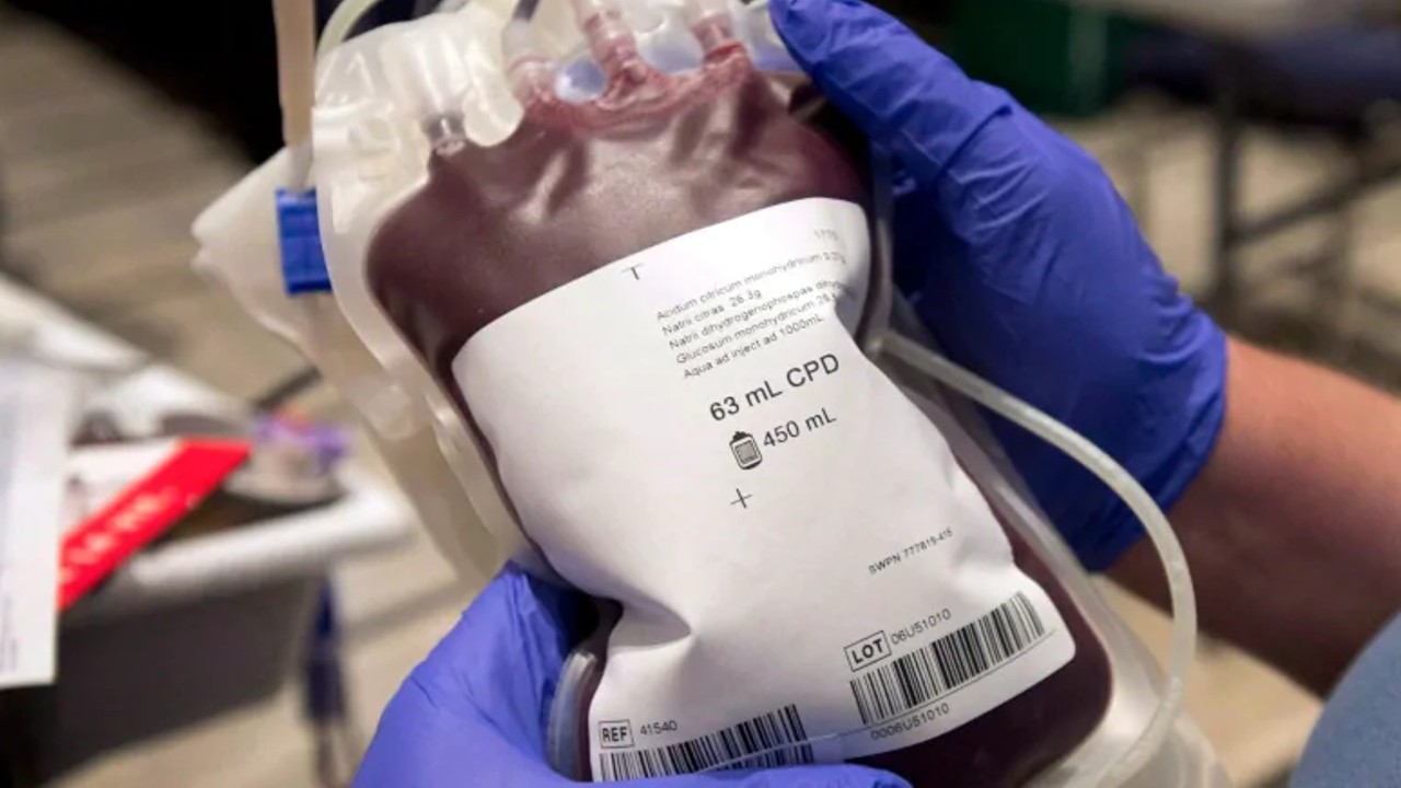 Federal Gov't Plans Blood Collection Centres In All 774 LGAs