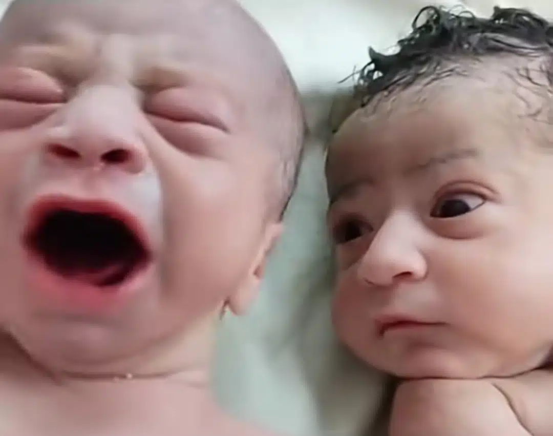 Newborn baby breaks internet with shocking stare at his crying twin brother.