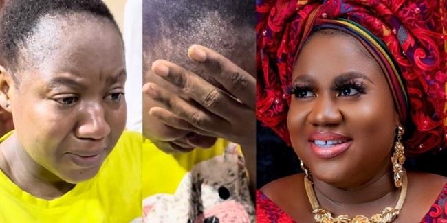 Nollywood actress opens up about ongoing battle with brain tumour