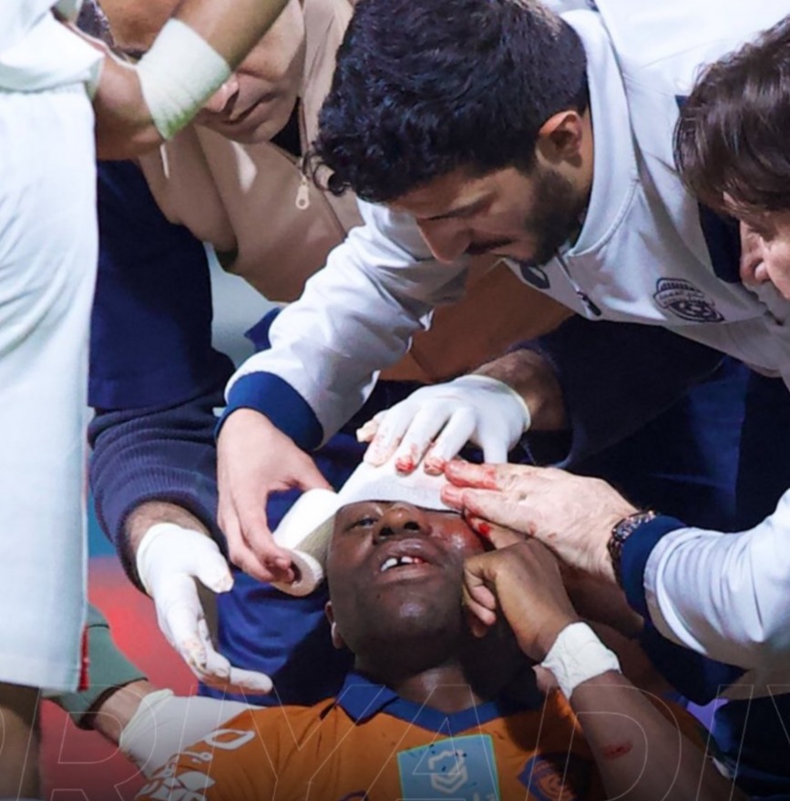 Sakala suffered a horror head injury playing for Al-Fayha