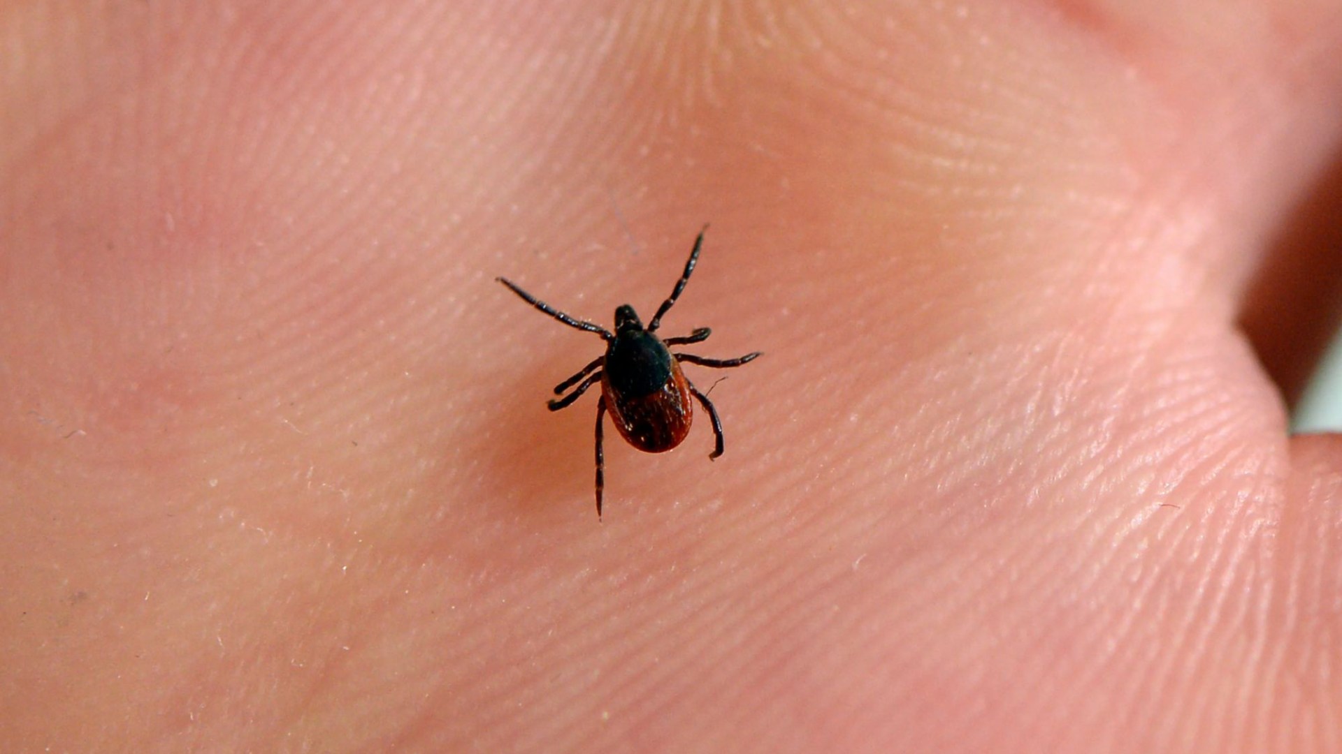 Woman, 28, loses her hair after being bitten by a common bug that's on the rise in the UK