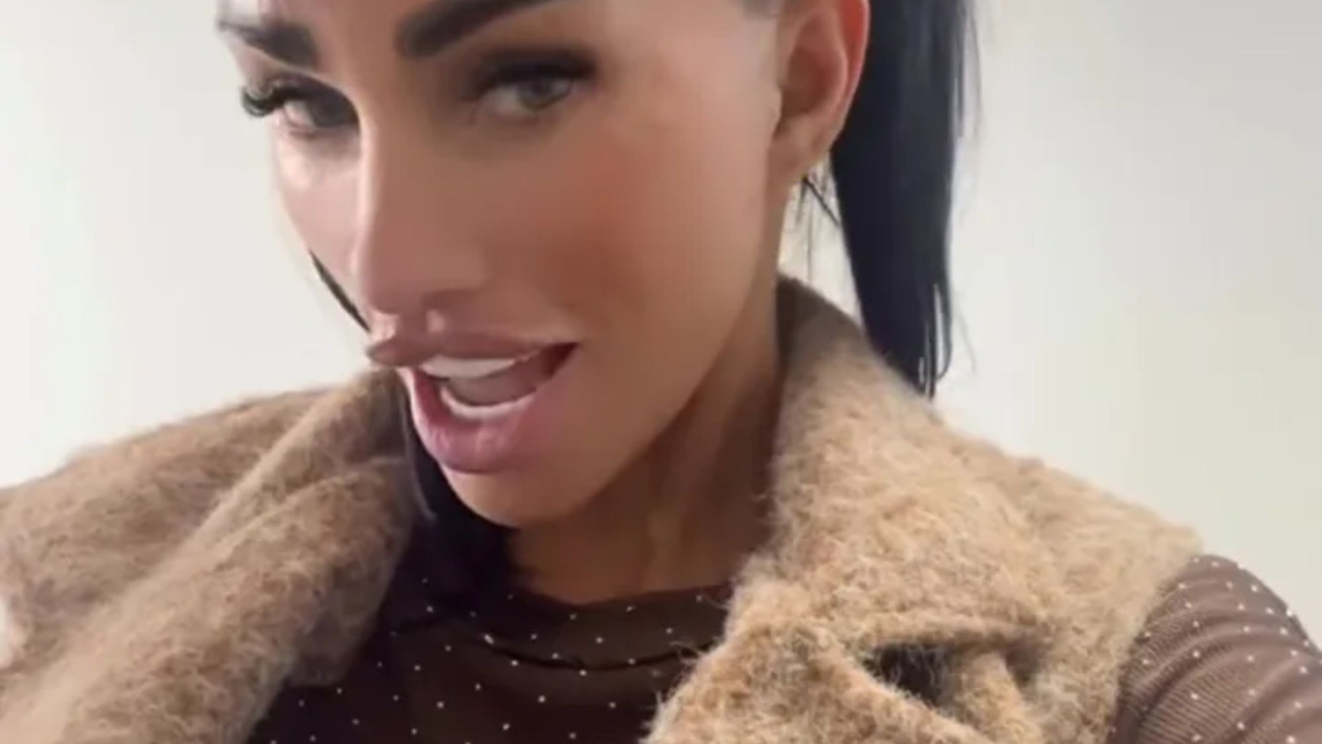 Katie Price gets her wrinkles removed despite new facelift - and she drags JJ along too