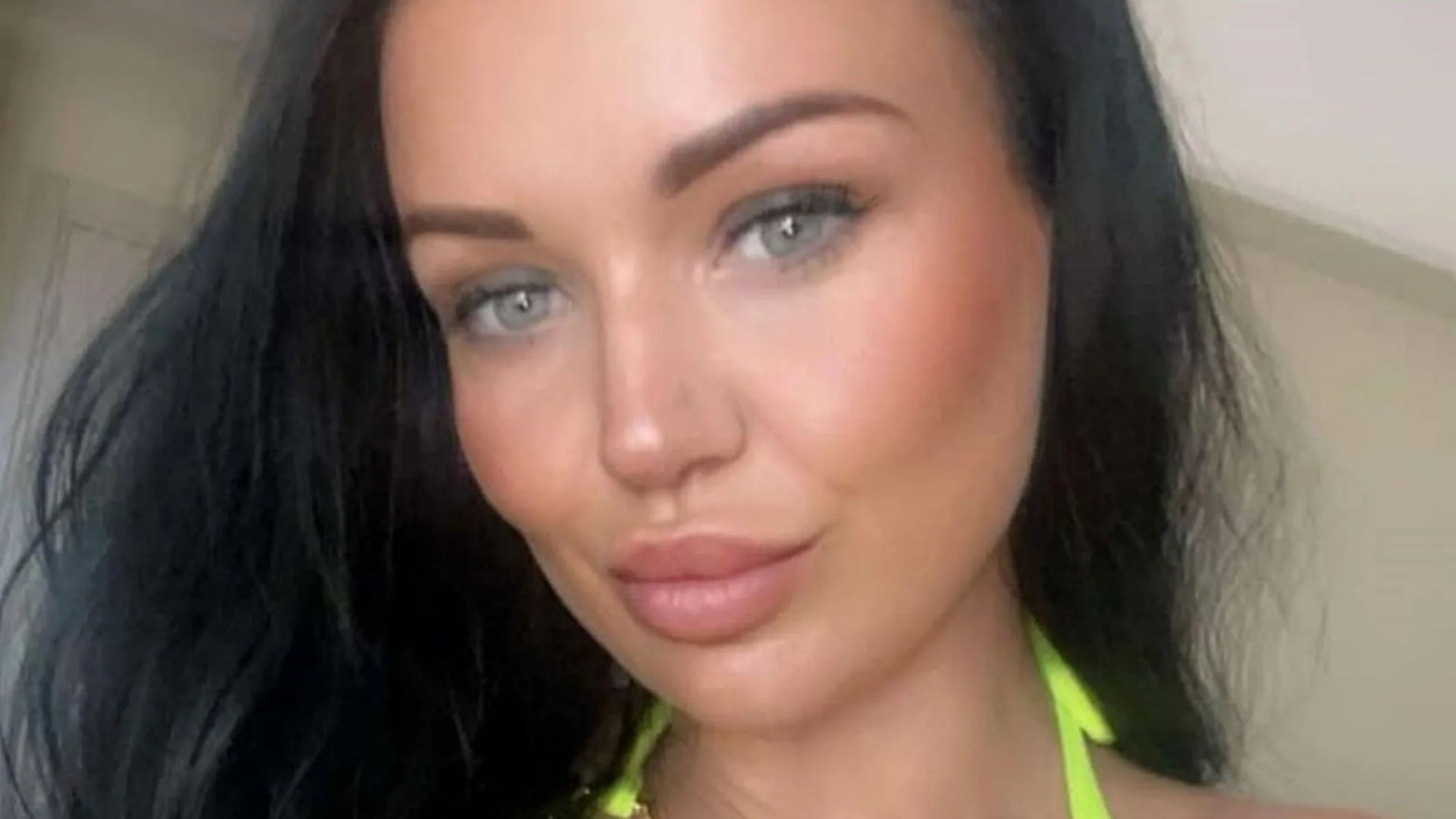 Mum, 31, left 'screaming in pain and vomiting blood' after using fat jabs 'to slim down for holiday'