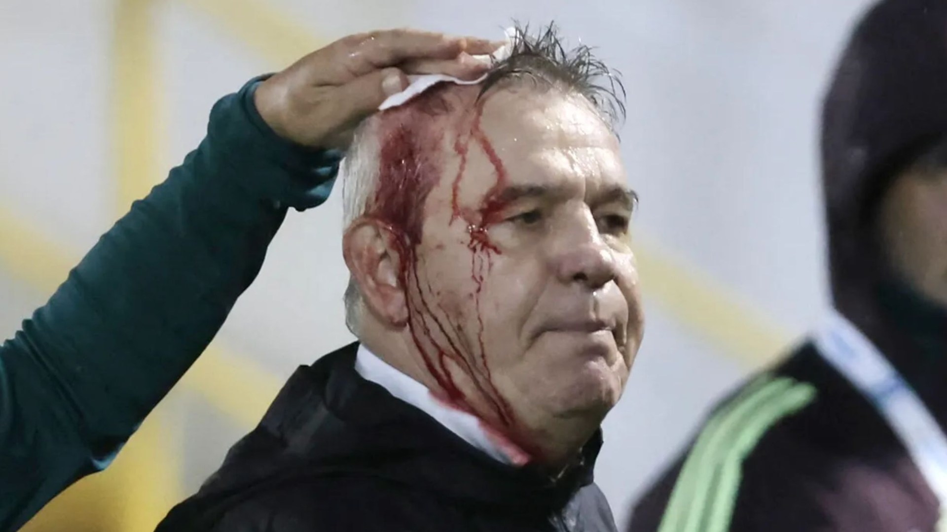 Emotional Celtic star shines for country but match overshadowed by horror moment manager left covered in BLOOD