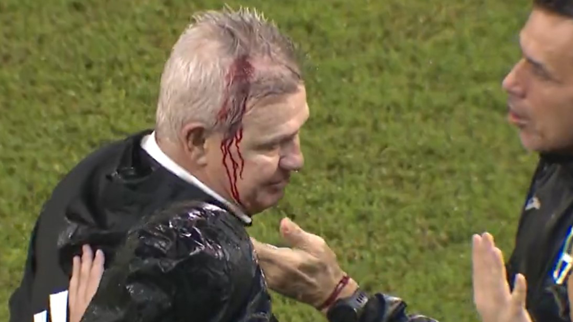 Mexico manager left with blood pouring down face after being hit with beer can thrown from crowd