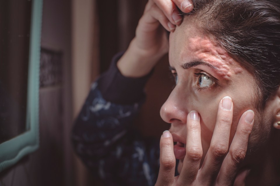 There are multiple potential causes to consider with forehead rashes