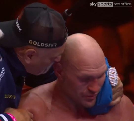 Fans and former boxers have called for Fury to shake-up his corner after his defeat to Usyk