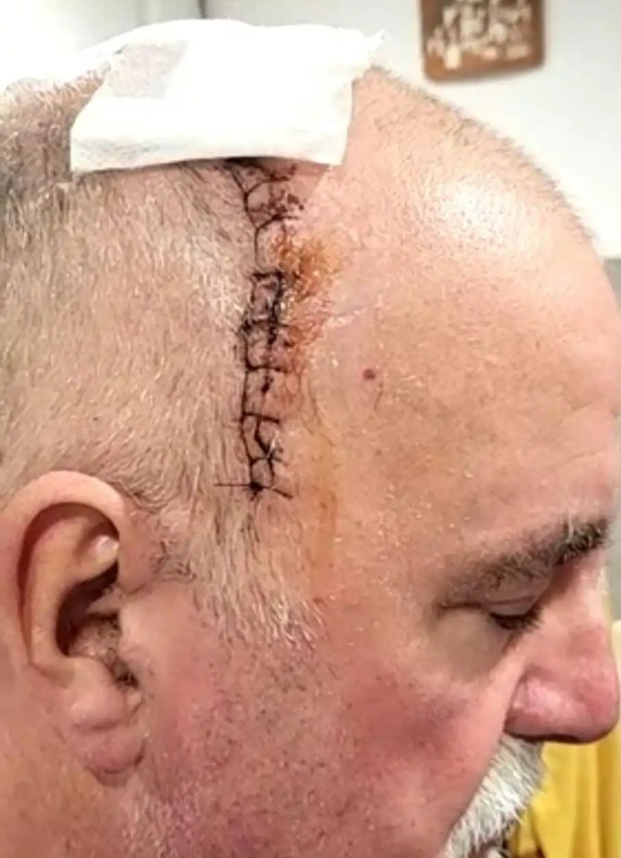 Colin Miller’s surgery scar