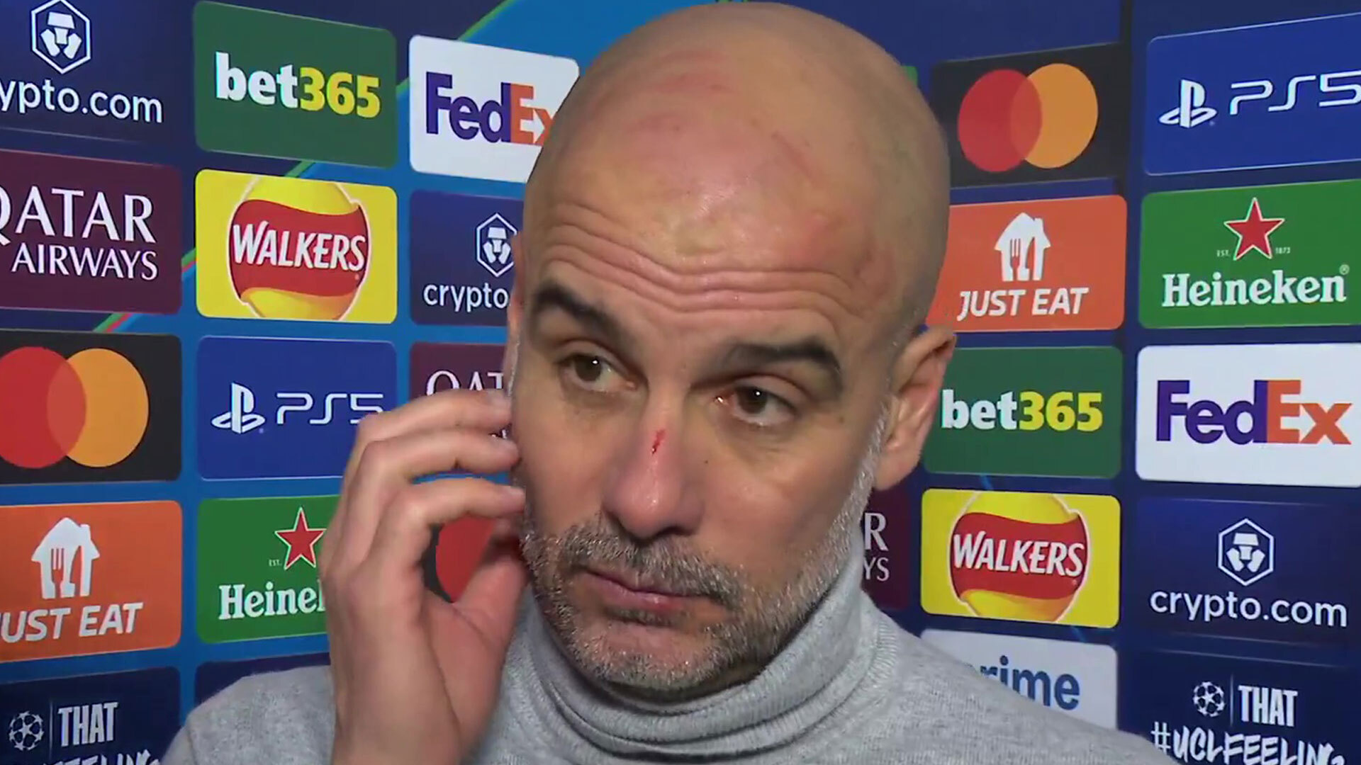 What Man City must urgently fix as it gets so bad for Pep Guardiola he is left with scratches all over head