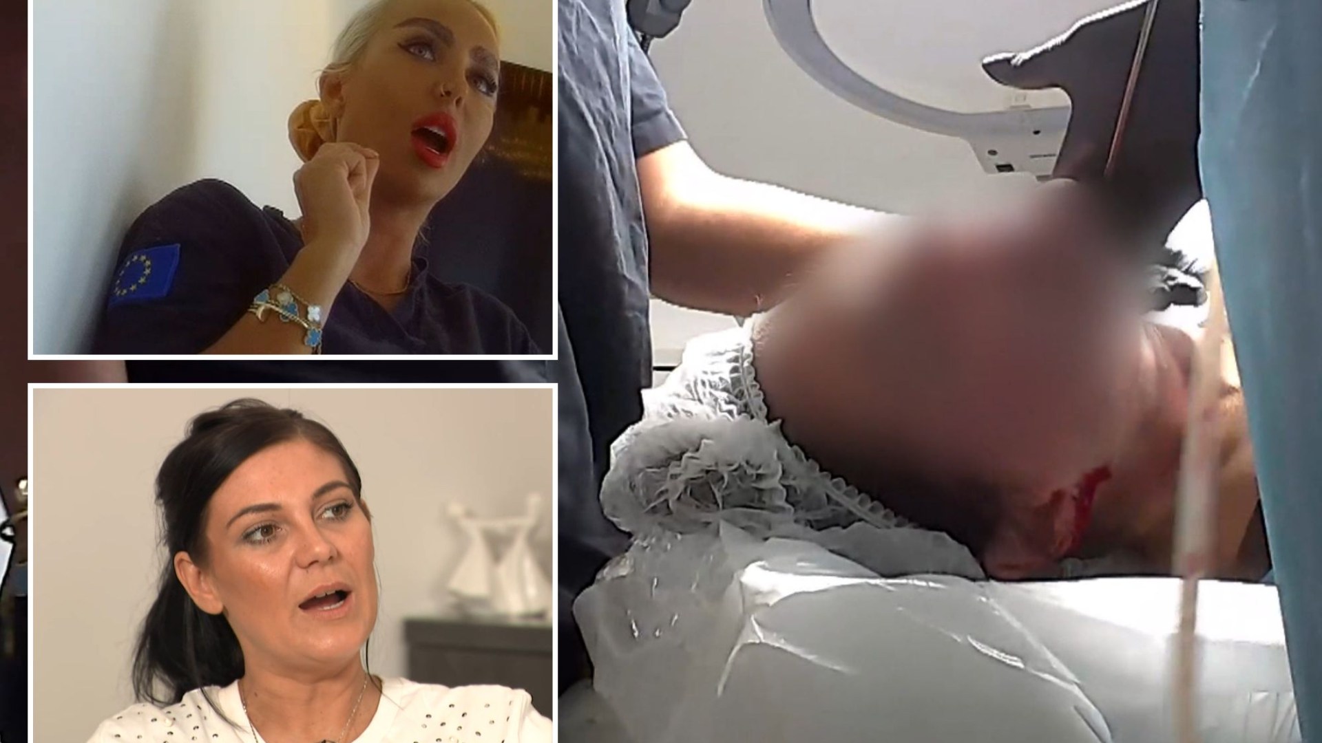 Shocking footage of woman’s jaw being sliced open uncovers the horrors of unregulated British cosmetic clinics