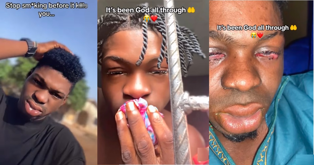 “Stop sm0king before it kpai you” – Man w@rns as he shares 'eye-catching' result of what sm0king did to him (VIDEO)