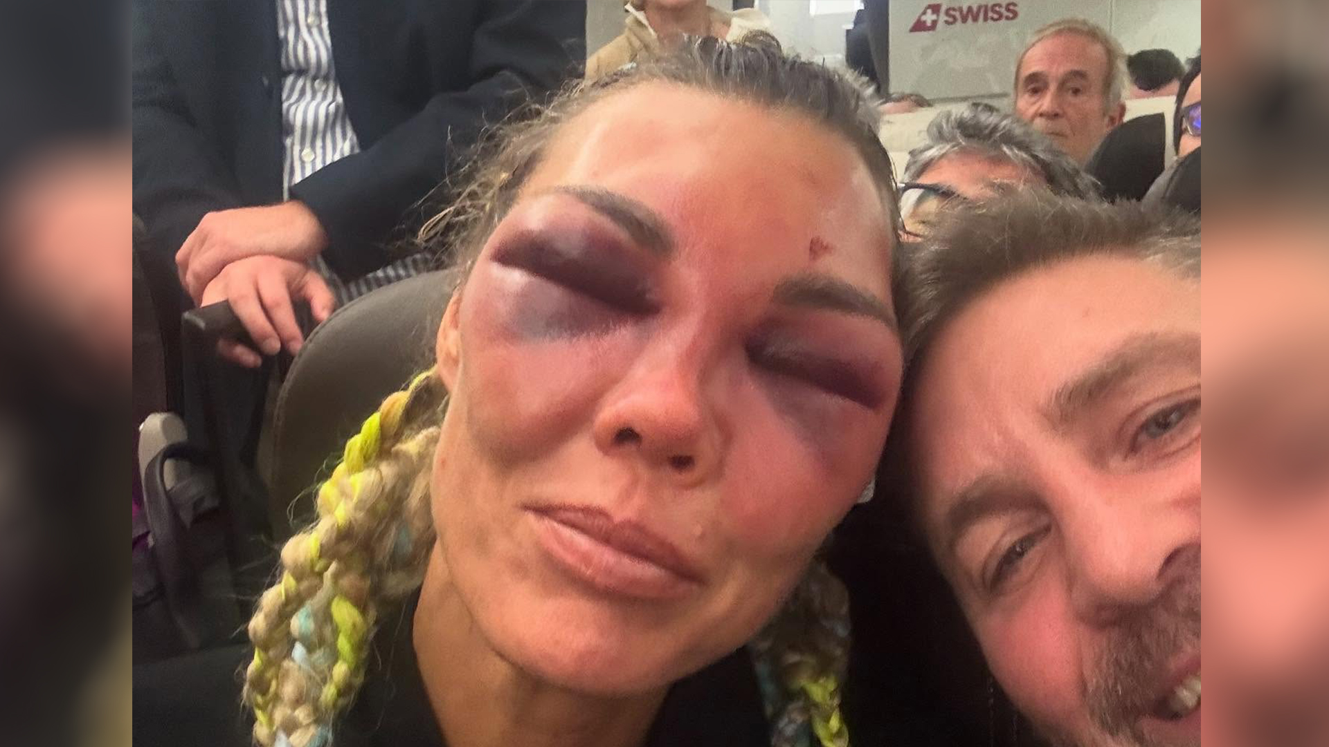 Boxer Mikaela Lauren, 48, left unrecognisable after horrific beating by world champion 15 years her junior