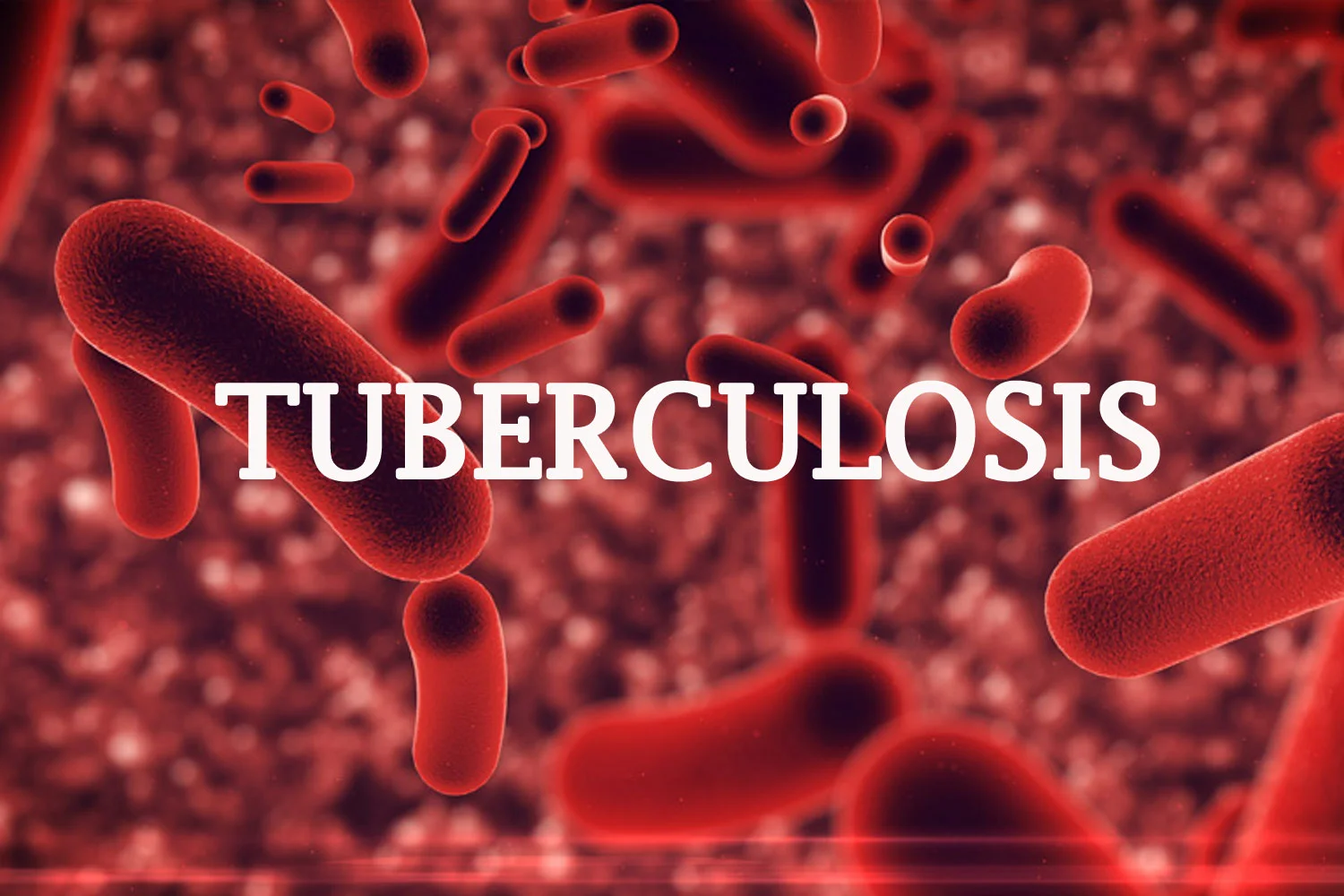 Leveraging Partnerships, Innovation To End Tuberculosis In Nigeria