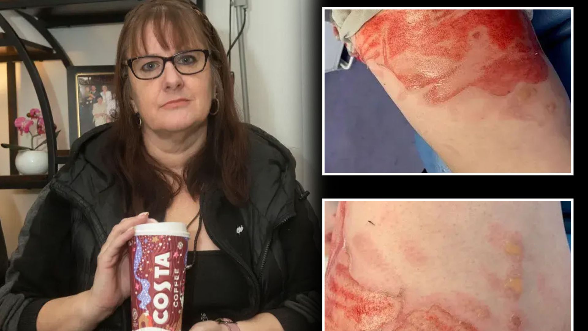 Mum 'scarred for life' by boiling hot drive-through drink to sue coffee giant Costa