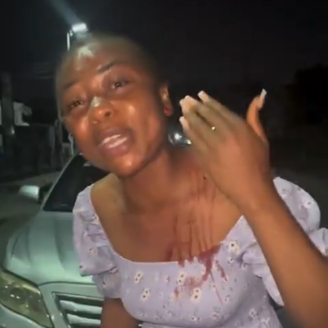 Lady accuses 4 Rivers police officers of assault, seeks help