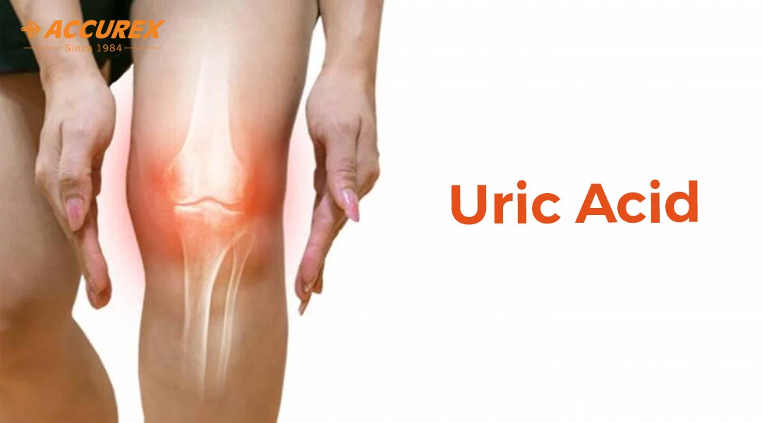 Ways To Reduce Uric Acid In The Body